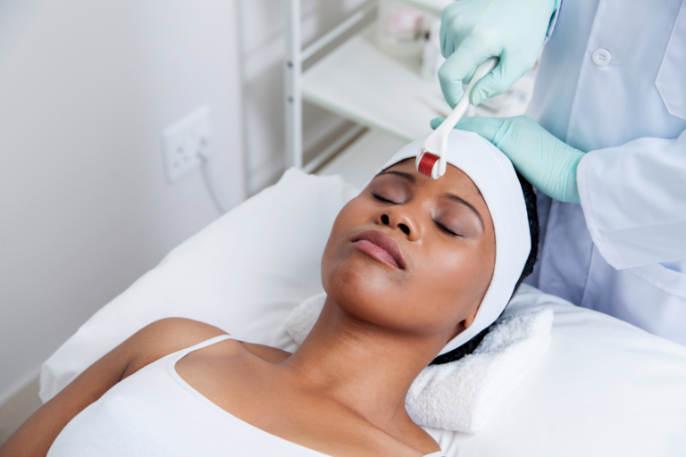 Microneedling North York